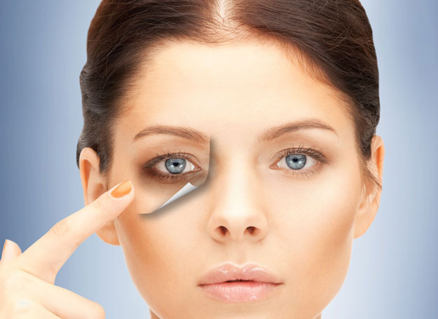 ipl for under eye circles
